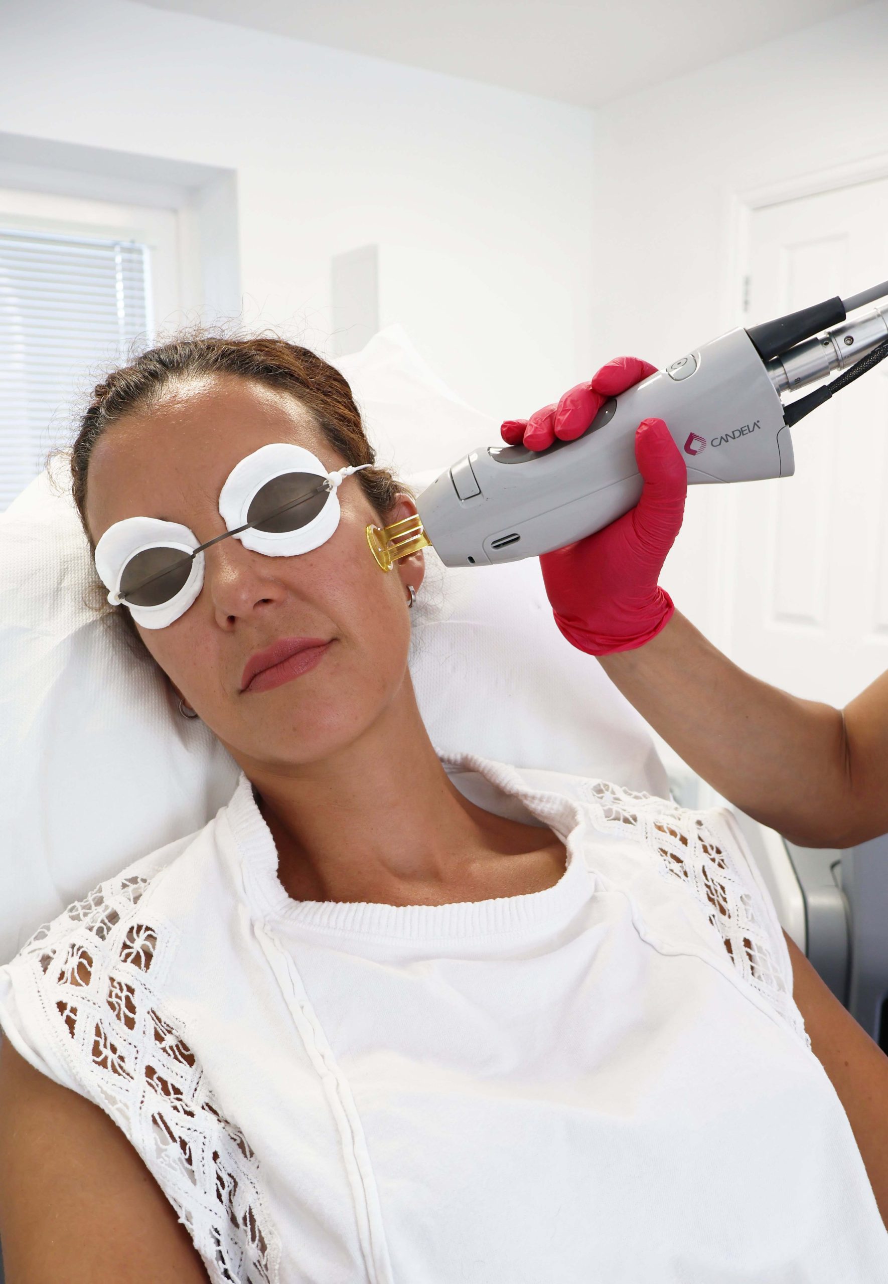 Cornwall Laser Tattoo removal clinic 30